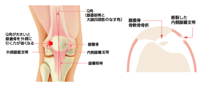 関節部分の説明図