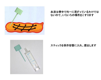 便潜血陽性とは