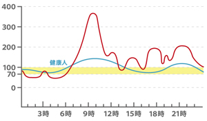 刻々と変動する血糖値についていけない!